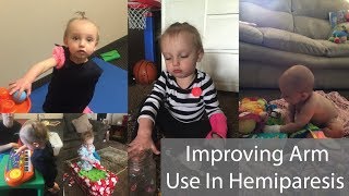 Improving Arm Use In Hemiparesis [upl. by Naujd159]