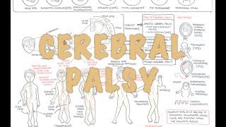 Cerebral Palsy  DETAILED Overview [upl. by Theda]